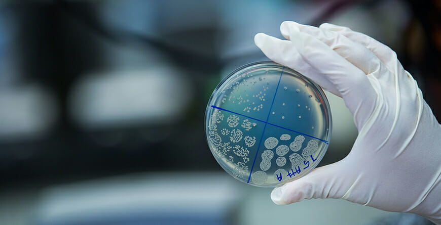 Hand with latex glove on holding petri dish with 4 areas of cell growth